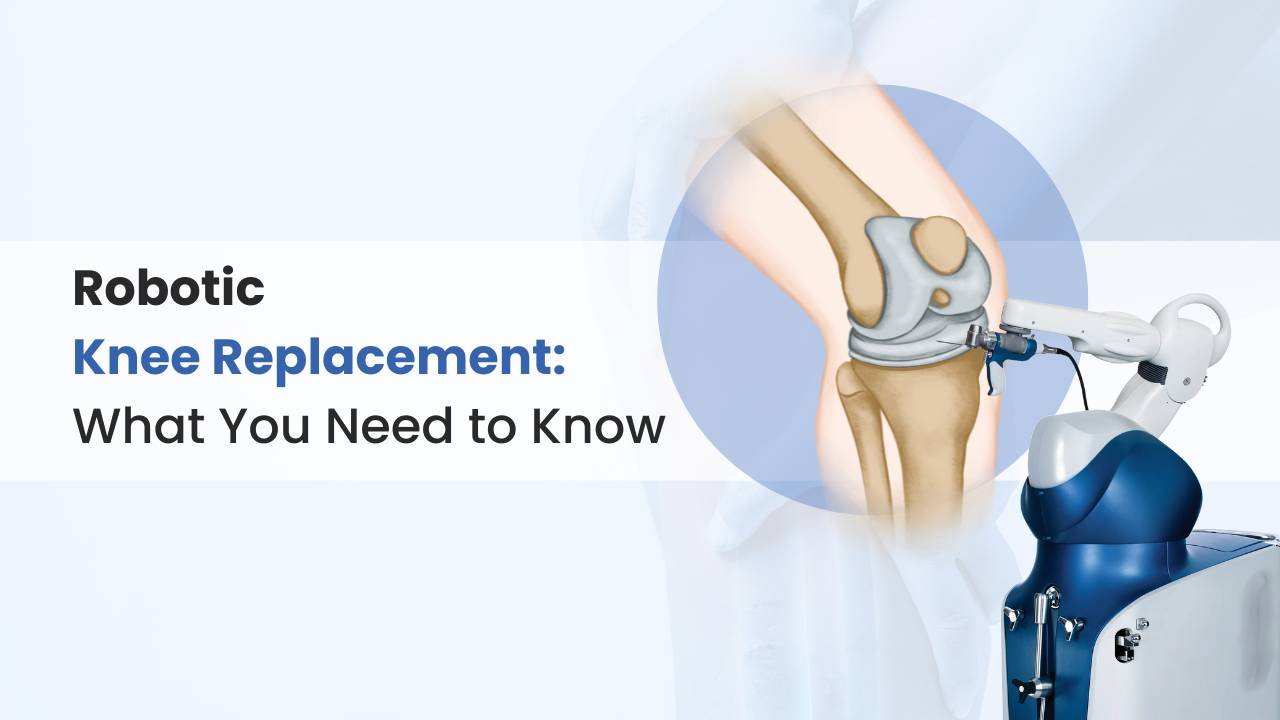 Robotic Knee Replacement Surgery: Benefits, Procedure & Recovery